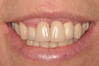 Before - Nigel Hargreaves