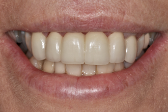 After - Nigel Hargreaves