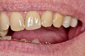 After - Nigel Hargreaves