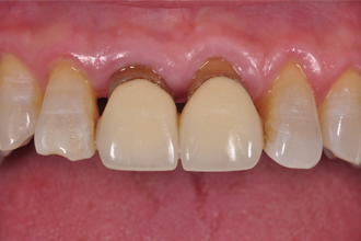 Before - Nigel Hargreaves