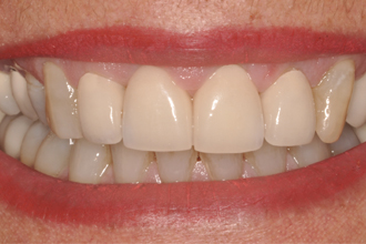 After - Nigel Hargreaves