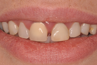 Before - Nigel Hargreaves