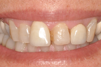 Before - Nigel Hargreaves