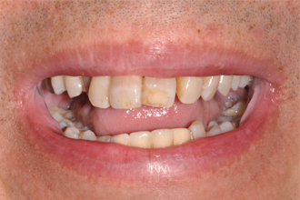 Before - Nigel Hargreaves