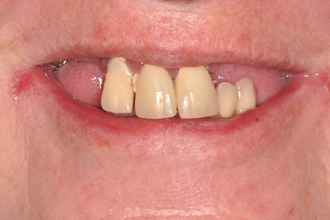 Before - Nigel Hargreaves