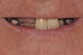 Before - Nigel Hargreaves