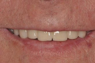 After - Nigel Hargreaves