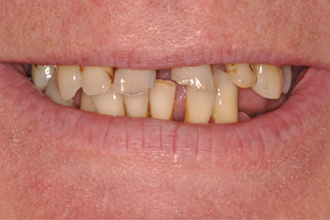 Before - Nigel Hargreaves