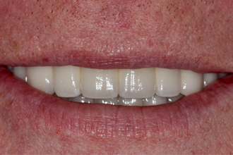 After - Nigel Hargreaves