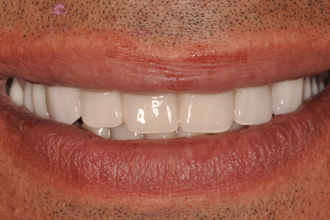 After - Nigel Hargreaves