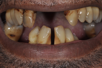 Before - Nigel Hargreaves