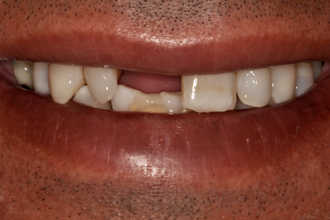 Before - Nigel Hargreaves