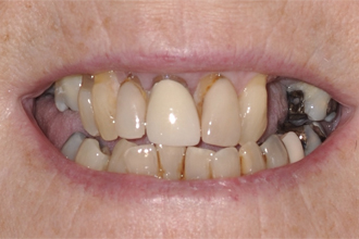 Before - Nigel Hargreaves