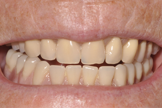 After - Nigel Hargreaves