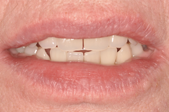 After - Nigel Hargreaves