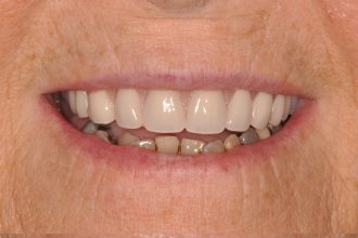 Before - Nigel Hargreaves