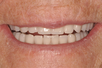 After - Nigel Hargreaves