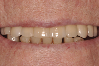 After - Nigel Hargreaves