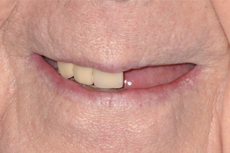 Before - Nigel Hargreaves