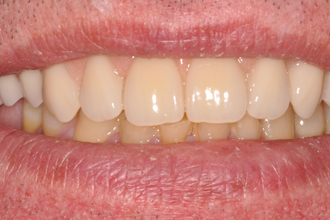 After - Nigel Hargreaves