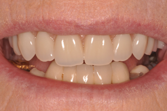 After - Nigel Hargreaves