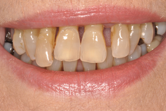 Before - Nigel Hargreaves