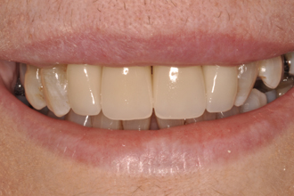 After - Nigel Hargreaves