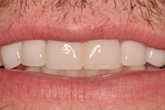 After - Nigel Hargreaves