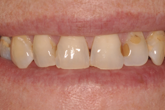 Before - Nigel Hargreaves