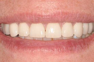 After - Nigel Hargreaves