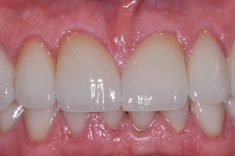 After - Nigel Hargreaves