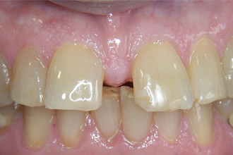 Before - Nigel Hargreaves