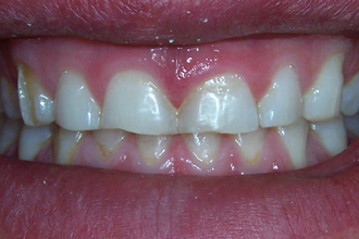 Before - Nigel Hargreaves