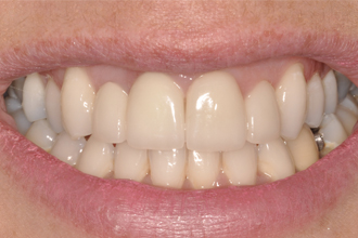 After - Nigel Hargreaves