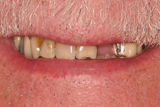 Before - Nigel Hargreaves