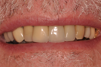 After - Nigel Hargreaves