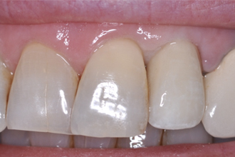 After - Nigel Hargreaves