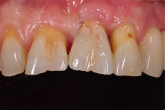 After - Nigel Hargreaves