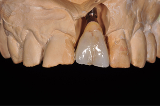 Before - Nigel Hargreaves