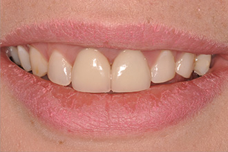 After - Nigel Hargreaves