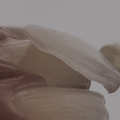 Treatment - Nigel Hargreaves