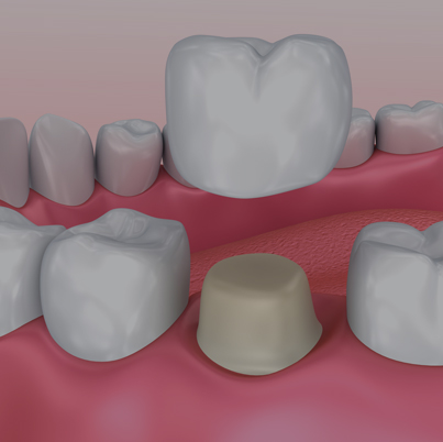 Treatment - Nigel Hargreaves